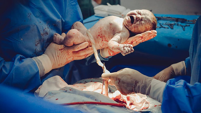 newborn baby at delivery time